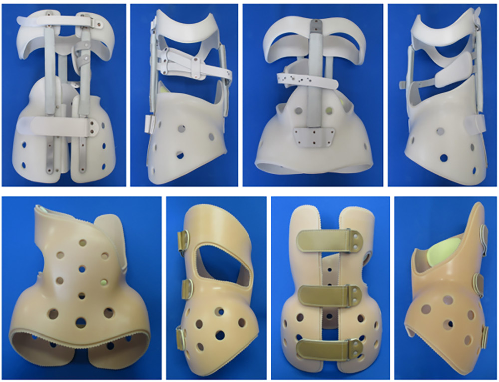 側弯症装具の例